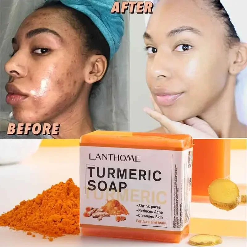 

Turmeric Soap Face Cleansing Anti Acne Whitening Skin Lightening Face Remove Pimples Dark Spots Lightening Ginger Handmade Soap