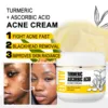 AILKE Turmeric Set, Whiten, Even Skin Tone, Hydrate, Removes Dark Spots, Lifts Dull Skin, Oil Control, Moisturize, Youthful Skin 3