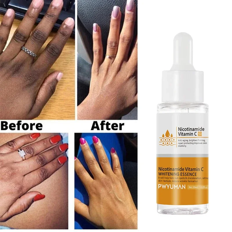 

Dark Knuckles Fast Whitening Serum Pigmentation Corrector for Black Skin Hand Knuckle Elbows Knee Intense Stains Remover Product