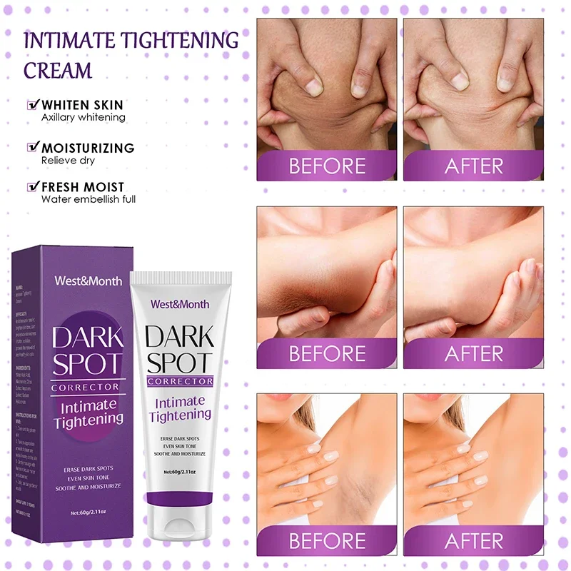 Remove Melanin Nicotinamide Brightening Cream For Dark Skin Effective Lighten Thigh Inner Bleach Private Parts Brighten Cream 4