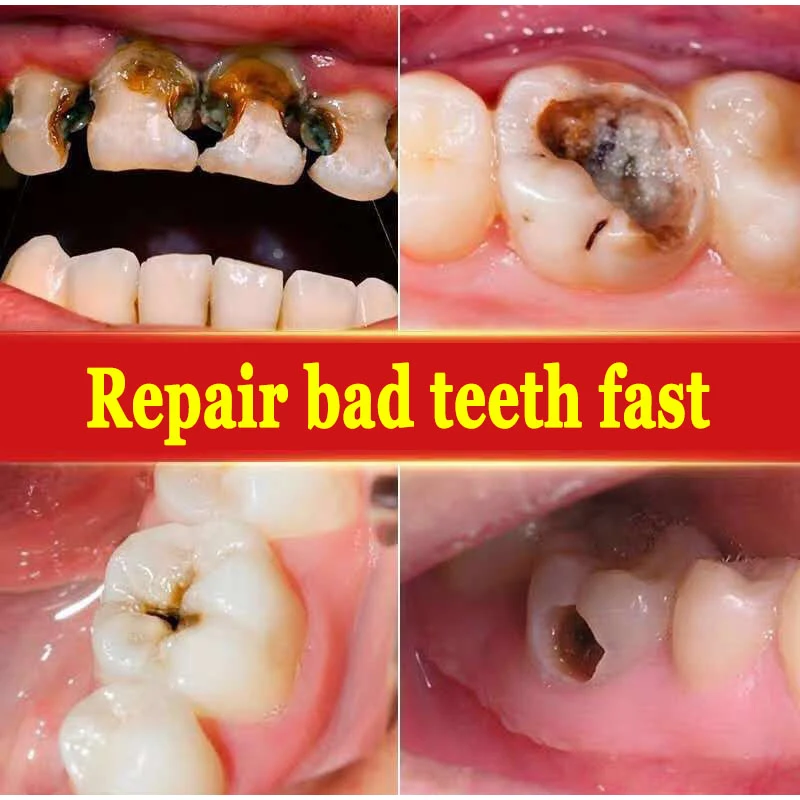تبييض الأسنان معجون الأسنان 2 قطعة إصلاح سريع من تجاويف إزالة التنفس الطازج من البلاك إصلاح العناية بالأسنان المنتج بالجملة