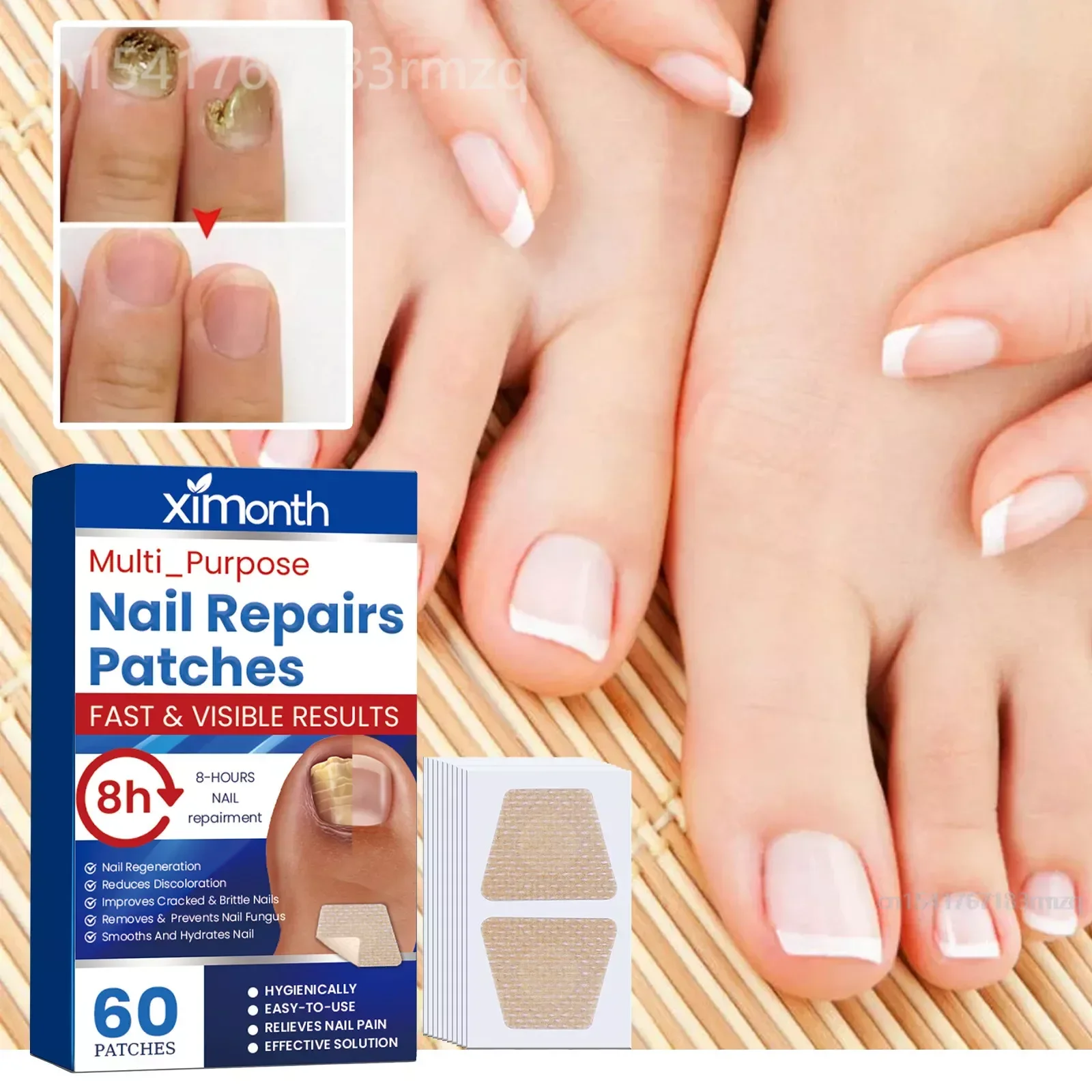 Toenail Fungus Treatment Stickers 60pcs/Box Paronychia Removal Treatment Nail Ingrown Correction Stickers Pedicure Tools Care