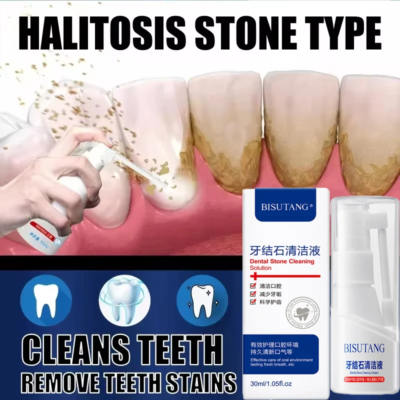 Dental Calculus Remover Teeth Whitening Spray Toothpaste Cleaning Oral Hygiene Removal Halitosis Plaque Stains Fresh Breath Care dental calculus remover