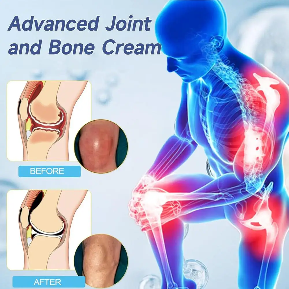 Hyaluronic Acid Joint R-epair Cream Pain Relief Cream Arthritis Joint Knee Analgesic Ointment Neck Lumbar Sciatica Synovial