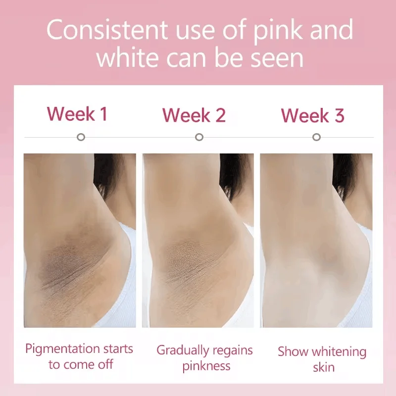 Inner Thigh Brighten Cream Bleaching Armpits Elbows Knees Moisturizing Body Lotion Cream Brighten Lightening Melanin Skin Cream 3