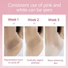 Inner Thigh Brighten Cream Bleaching Armpits Elbows Knees Moisturizing Body Lotion Cream Brighten Lightening Melanin Skin Cream 3