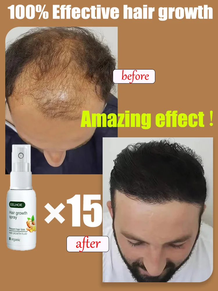 Fast Hair Growth Oil Natural Effective Anti Repair Baldness SeborrheicHereditary Postpartum Hairs Loss