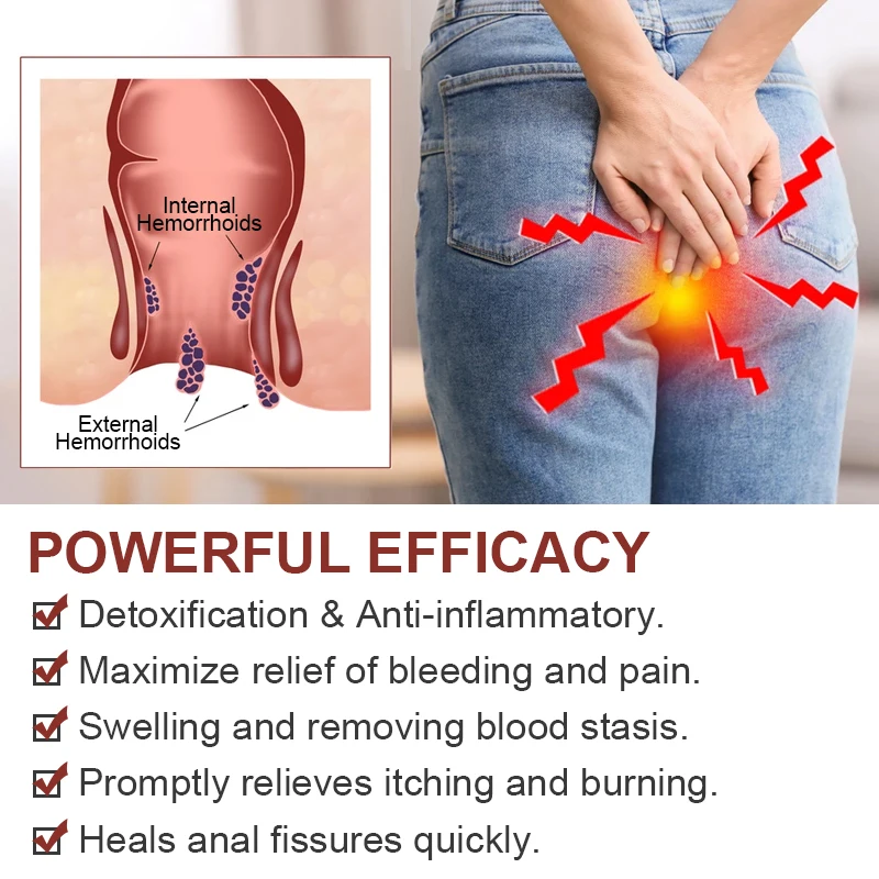 1Pcs Hemorrhoids Ointment Antibacterial Relief Anus Pain Swell Chinese Medical Herbal Cream For Internal Piles Anal Fissure S027