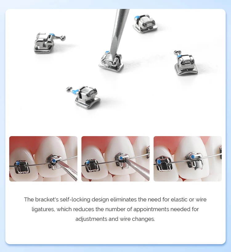 20 Teile/paket Dental Kieferorthopädische Metall Selbstligierende Klammern Hosenträger Ortho Monoblock Roth MBT 0,022 3-4-5 haken Zahnmedizin Werkzeuge – Detail 5