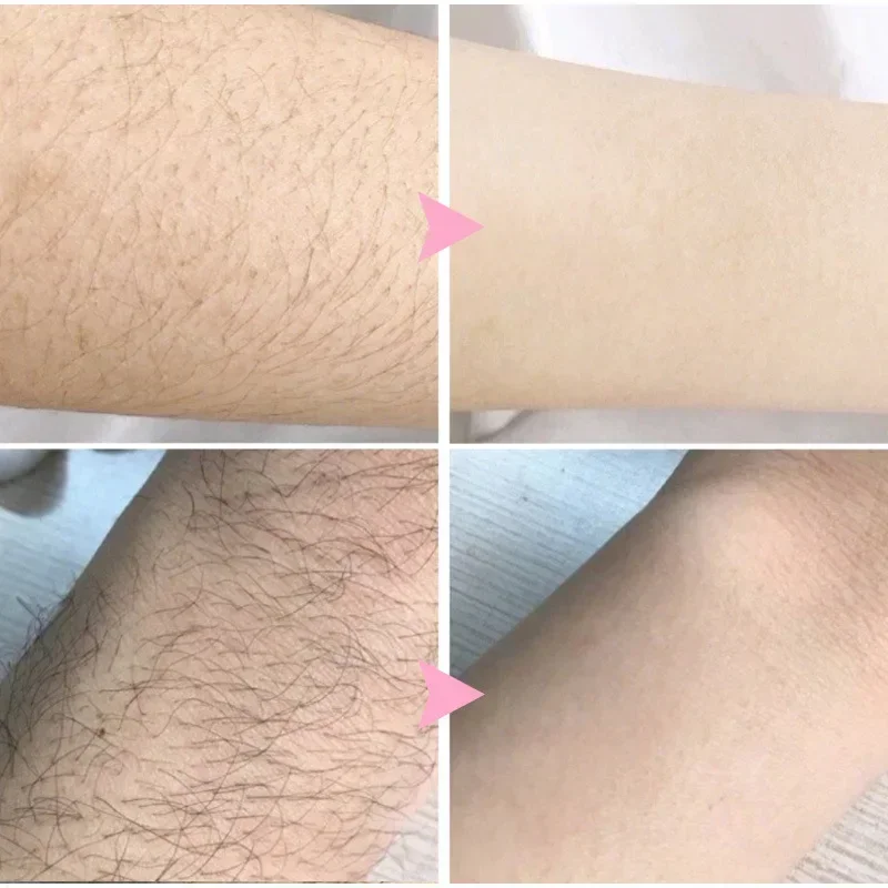 2 Minutes Fast Hair Removal Spray Painless Hair Growth Inhibitor Arm Armpit Leg Permanent Depilatory for Men Women Repair Care 4
