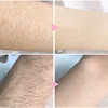 2 Minutes Fast Hair Removal Spray Painless Hair Growth Inhibitor Arm Armpit Leg Permanent Depilatory for Men Women Repair Care 4