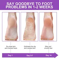 Chaussettes exfoliantes pour les pieds, masque pour éliminer les callosités et peaux mortes, soin des pieds, chaussettes exfoliantes pour bain de pieds, outils professionnels de pédicure 3