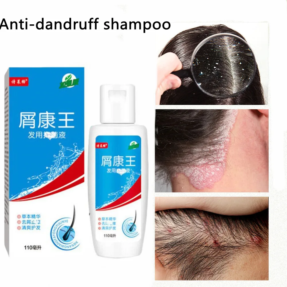

110ML Hair Psoriasis Seborrheic Skin Care Treatment Dermatitis Eczema Compound Remove Dandruff Herbal Shampoo