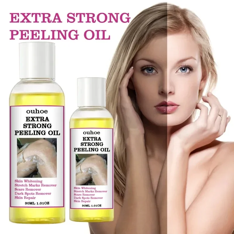 

Sdotter Yellow Peeling Oil Dark Skin Bleaching Remove Arm elbow Knee Legs Melanin Body Brighten Exfoliating Dead Skin Care White