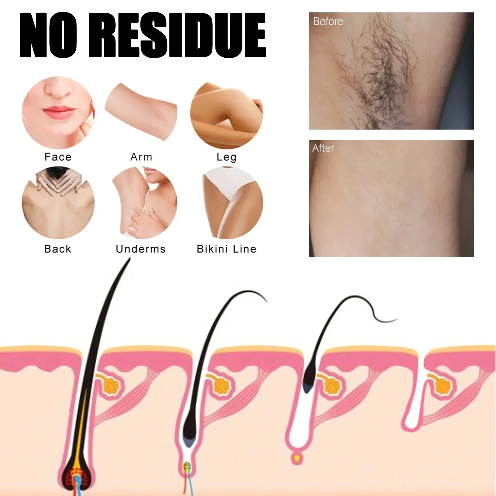 Hair Removal Spray Permanent Hair Growth Inhibitor Armpit Leg Arms Remover Depilatory Norish Body Care Cream