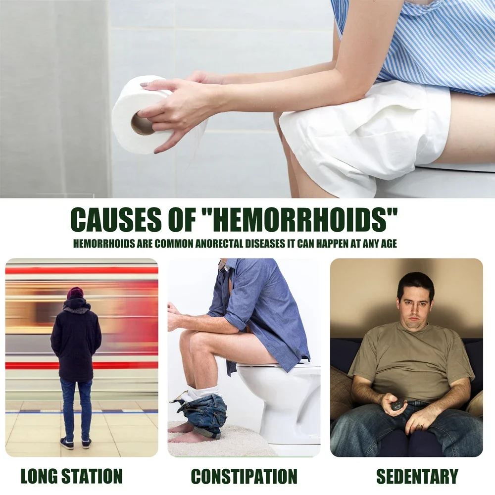 30ml Hemorrhoid Remover Spray Removal Internal Piles Natural Herbal Hemorrhoid Spray Soothing Pain