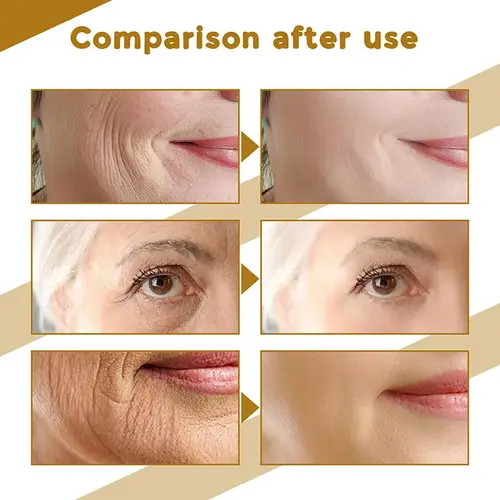 Centella Asiatica Face Serum Nourish Dry Skin Smoothing Rejuvenation Skin Brightening Whitening Cream Facial Moisturizer Korean - Image 2