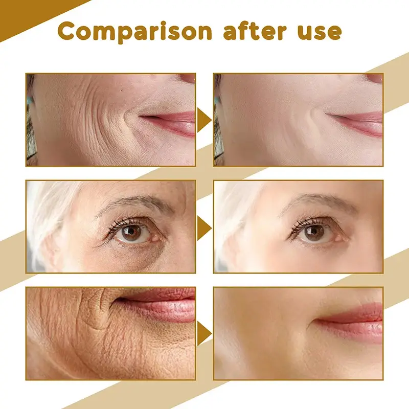 Centella Asiatica Face Serum Nourish Dry Skin Smoothing Rejuvenation Skin Brightening Whitening Cream Facial Moisturizer Korean - Image 2