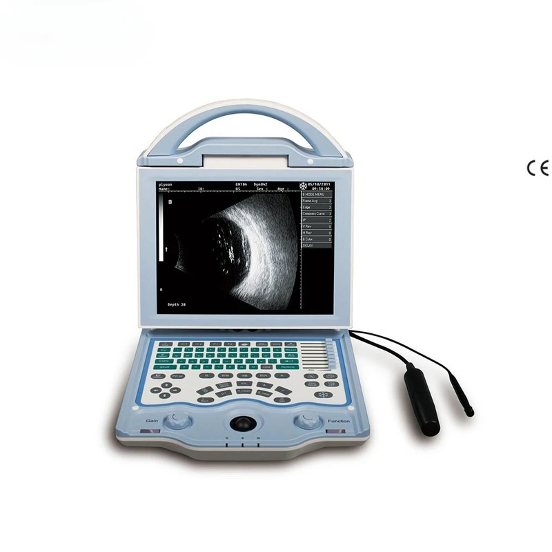 

a/b scan ophthalmic ultrasound SUN-AB, ophthalmology, portable ophthalmic