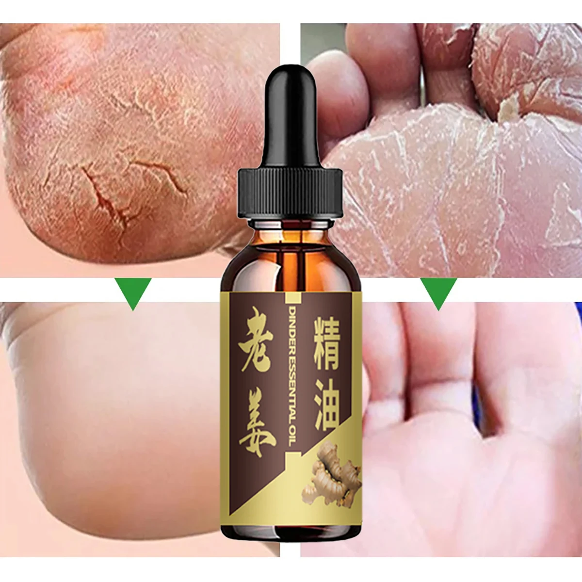 Natural Ginger Oil Lymphatic Drainage Therapy Anti Aging Plant Essential Oil Promote Metabolism Full Body Slim Massage Oils luckymarche le match essential slim fit t shirt qwtax23311bkx