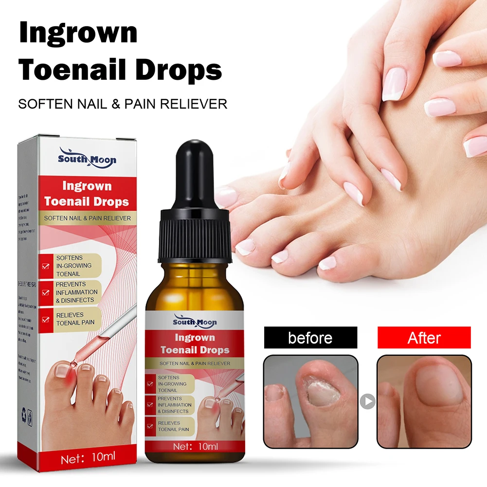 Ingrown Toenail Treatment Serum Nail Correction Recover Oil Pain Reliever  Nail Softener Trim With Ease Oil Feet Health Care Safe - Foot Care Tool -  AliExpress