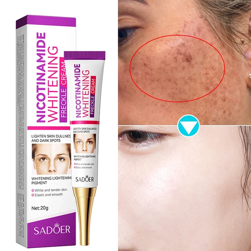 

Freckle Removing Cream Nicotinamide Whitening Remove Melasma Melanin Dark Spot Corrector Fade Acne Marks Moisturizing Skin Care