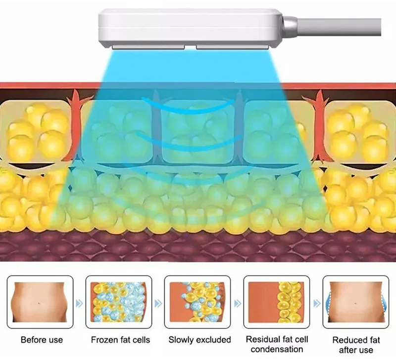 New Product Slimming 8 Handles Diamond 8 Cryo Pads Machine Weight Loss Fat Melting Cellulite Reduce cryoskin EMS