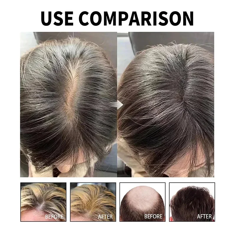 Hair Growth Serum Fast Hair Growth Oil Africa Crazy Traction Alopecia Serum Anti Hair Break Thicken Loss Treatment Spray Man Women 60ML