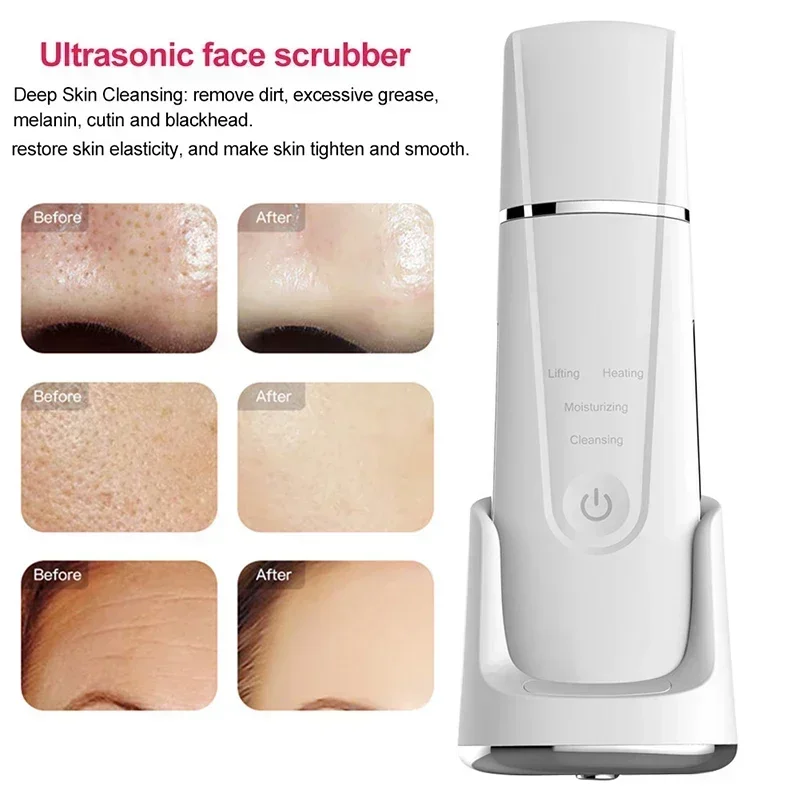 Electric Ultrasonic Skin Deep Cleaning Peeling Shovel Ultrasonic Cleaner Beauty Machine Facial Skin Care Face Lifting Machine