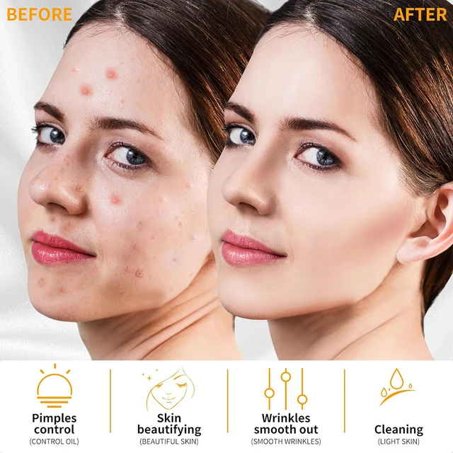 69073-d9100b.jpg High Frequency Electrotherapy Neon Facial Skin Massage Wand for Acne Skin Rejuvenation Tightening Face Wrinkle Reducing Machine