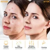 Electrode Glass Tube High Frequency Machine Neon + Argon Wand For Face Skin Spa Anti Wrinkle Acne Spots Remover Hair Frizz Care 5