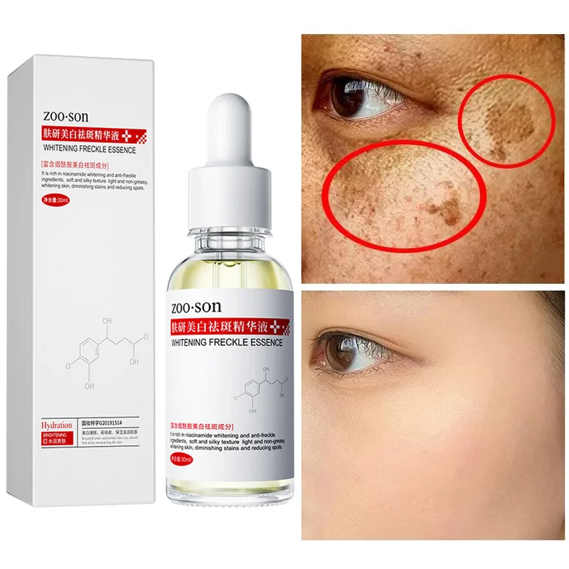 Dark Spot Corrector Whitening Serum Face Bleaching Serum Brighten Blemish Freckle Remover Natural Nicotinamide Essence Skin Care