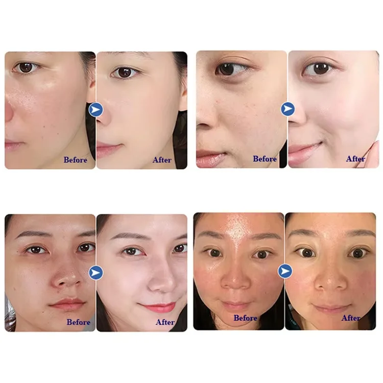 2025/High Pressure 450nm Blue Light Facial Care Nano Spray Water Pen for Facial Deep Hydration