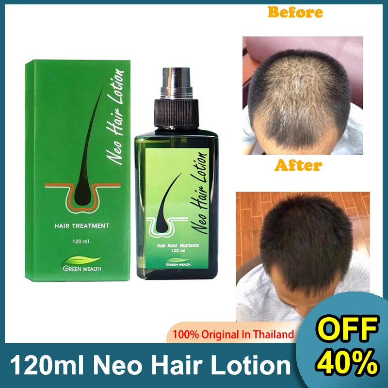 NEO HAIR LOTION ORIGNAL SPRAY 100% free gift Hair Transplant and Hair Loss  Treatment GMP Thailand Green Wealth hair grow | Lazada
