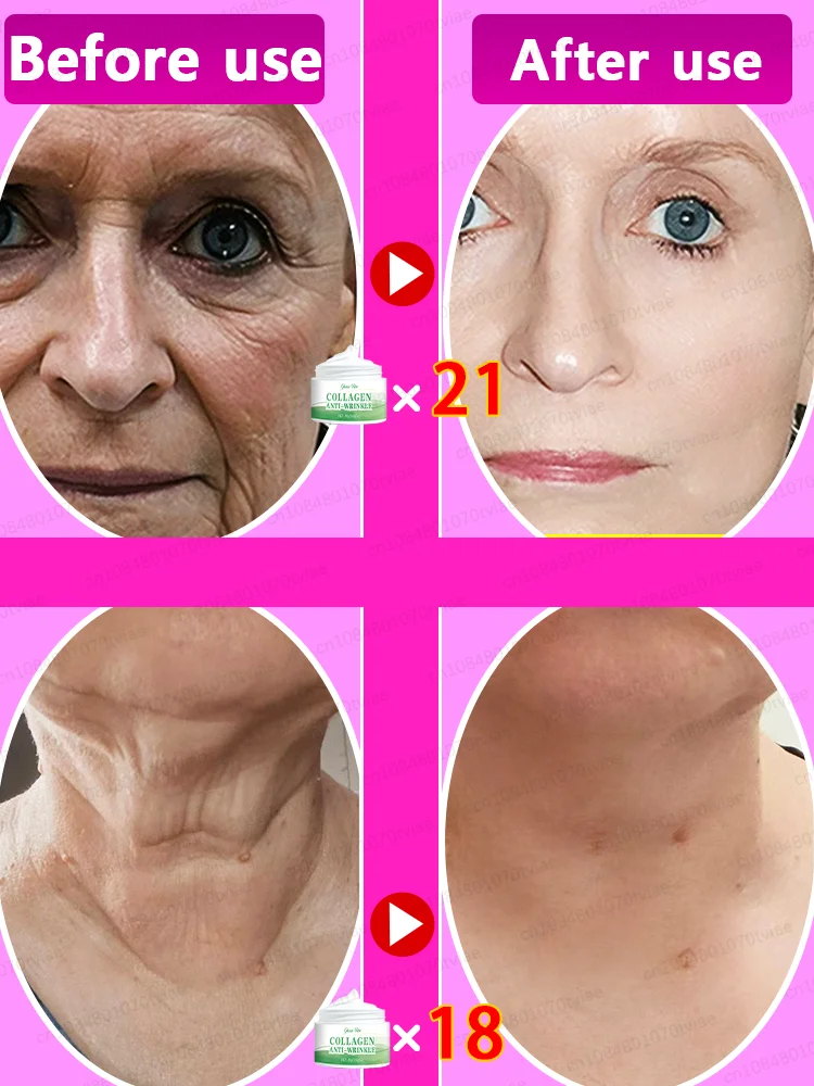 Repair skin, reshape skin factors, remove wrinkles and anti-aging,18 years younger. 4
