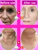 Repair skin, reshape skin factors, remove wrinkles and anti-aging,18 years younger. 4