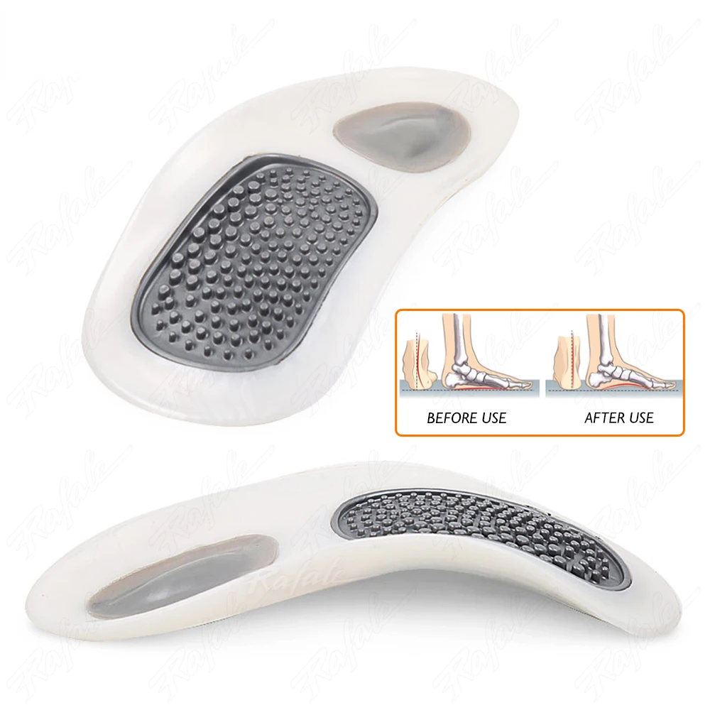 Orthotics Cubitus Varus Orthopedic Insoles Feet Pads Flatfoot Correction Arch Support Massage Insert