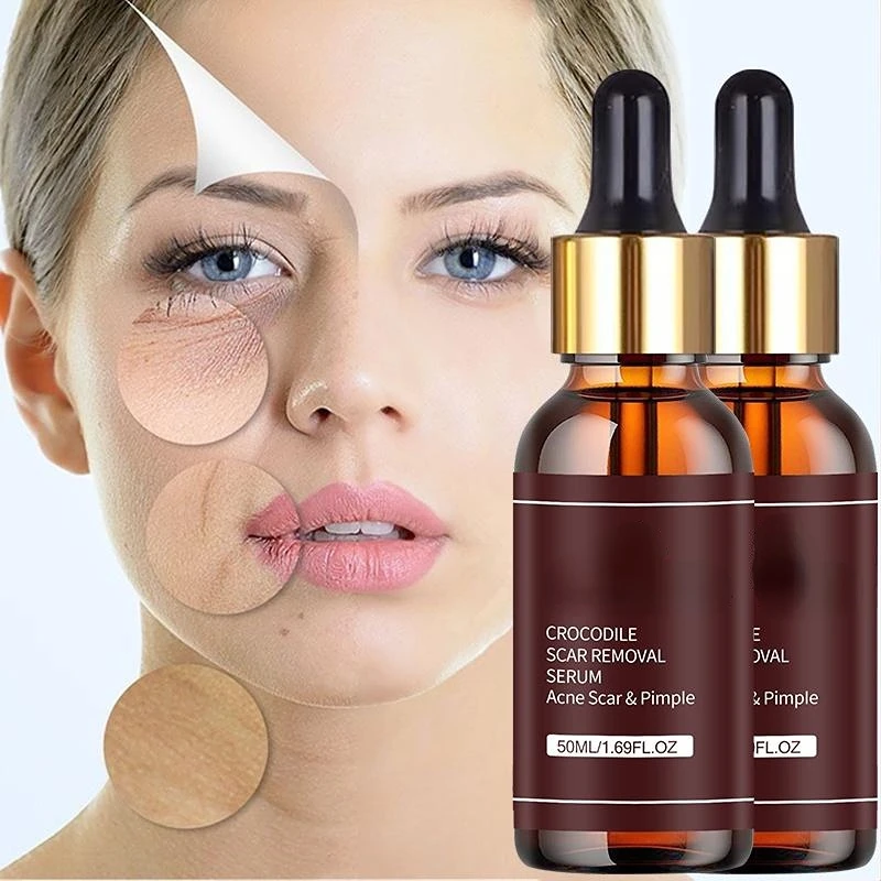 Retinol Face Serum Moisturizing Repair Skin Whiten Antiaging Anti