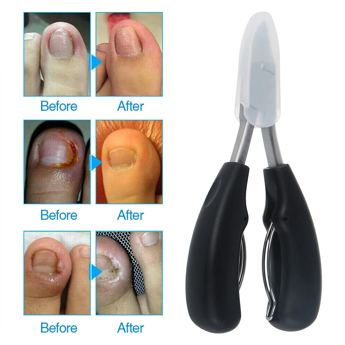 Toe Nail Clipper Nail Clippers 2/1pc Nail Scissors Toe Nail Clippers Stainless Steel Toenails Trimmer Thick Dead Skin Remover