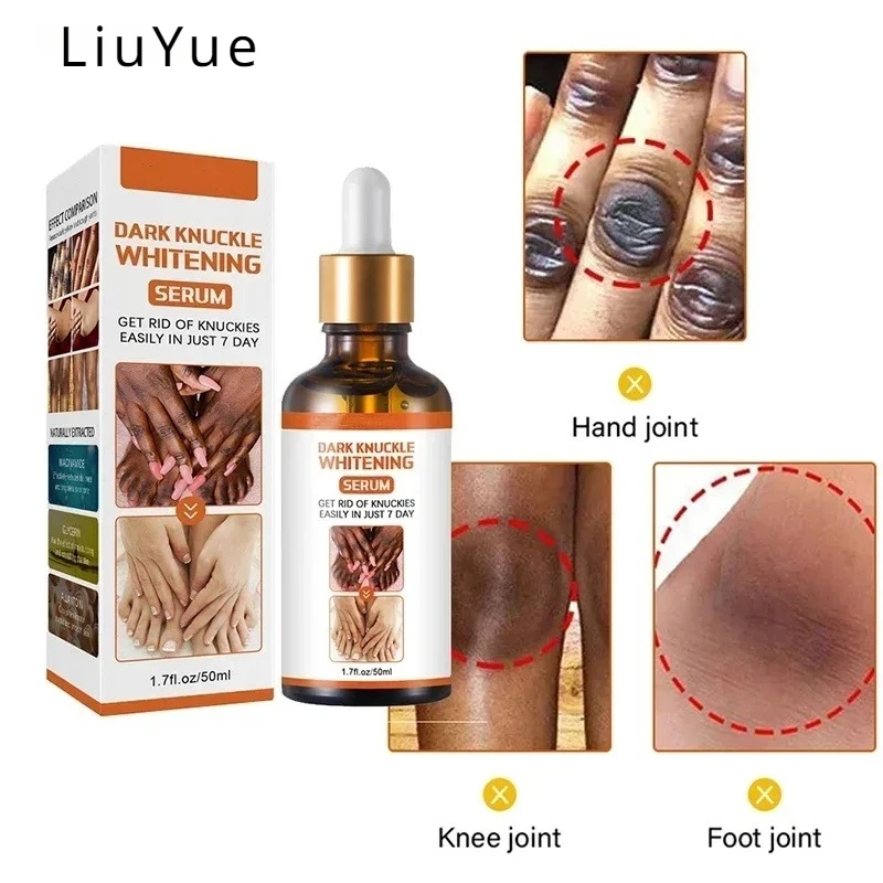 Whitening Essence Dark knuckles Finger elbows Knee spots Fade melanin remove dark serum stains Brightening white Moisturizing women finger joints whitening serum powerful removal melanin essence elbows knee whiten serum dark skin brightening products