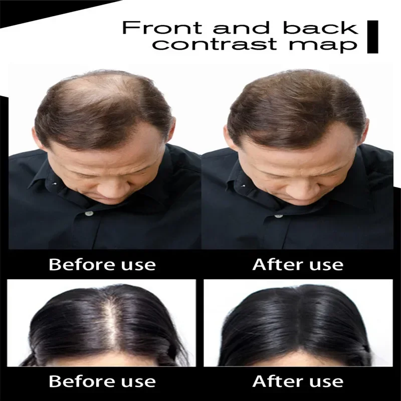 20pcs Hair Building Fiber Hair Loss Hairline Spray Authentic Keratin Colorful Fibers Regrowth Powder Optimizer Dense Growth hair building powder hair building fibers hair growth spray