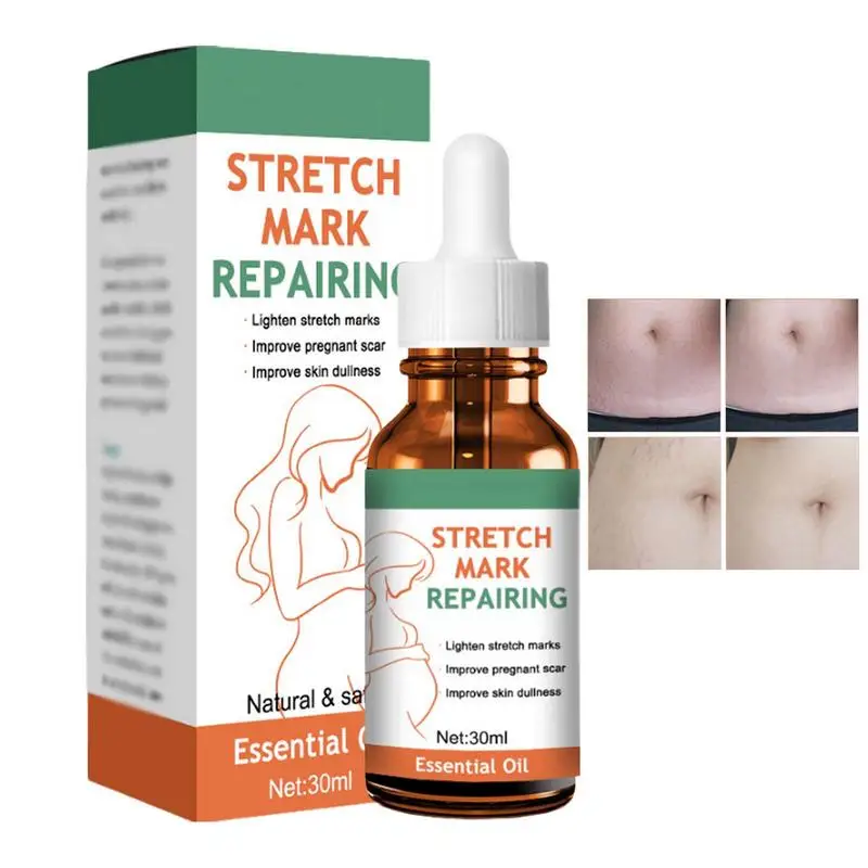 

Stretch Mark Essence Remover 30ml Natural Stretch Marks Removal Moisturizing Belly Butter Pregnancy Stretch Mark Prevention