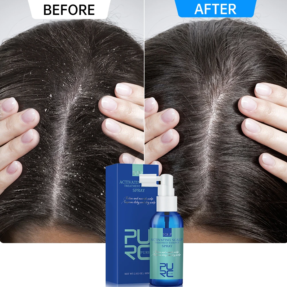 

PURC Hair Scalp Treatment Hair Oil Dandruff Itching Anti Loss Oil Control Smoothing Essence Spray Hair Care Beauty Health 60ML