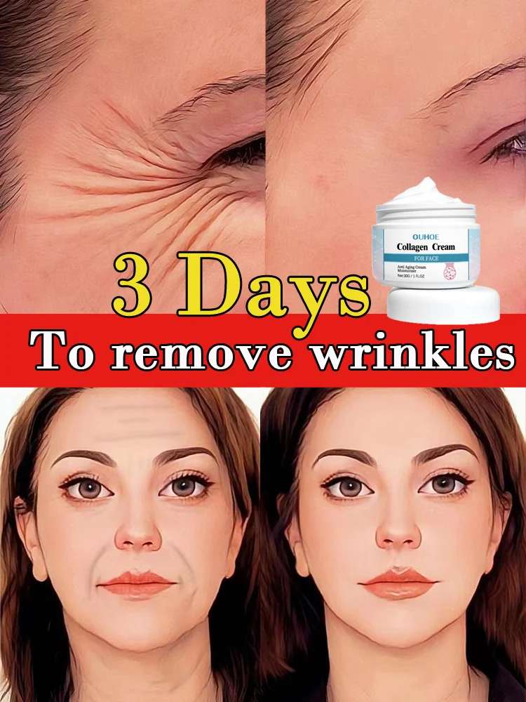 Wrinkle reduce cream face remove nasolabial folds expression lines