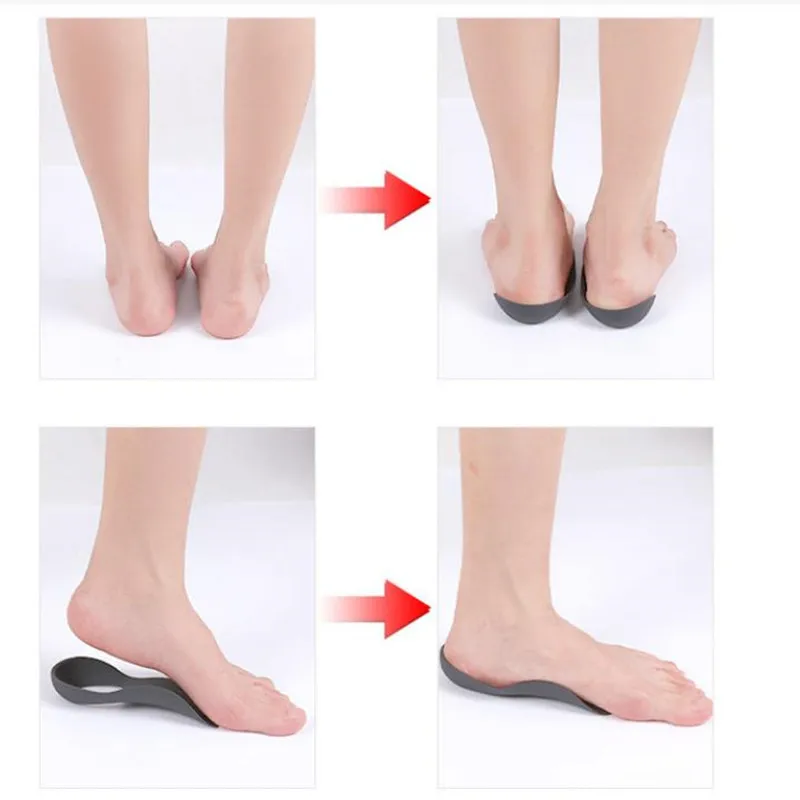 1Pair EVA Orthopedic Insoles for Men Shoes Orthotic Flat Foot Arch Plantar Fasciitis Inserts Feet Massage Foot Care Tools
