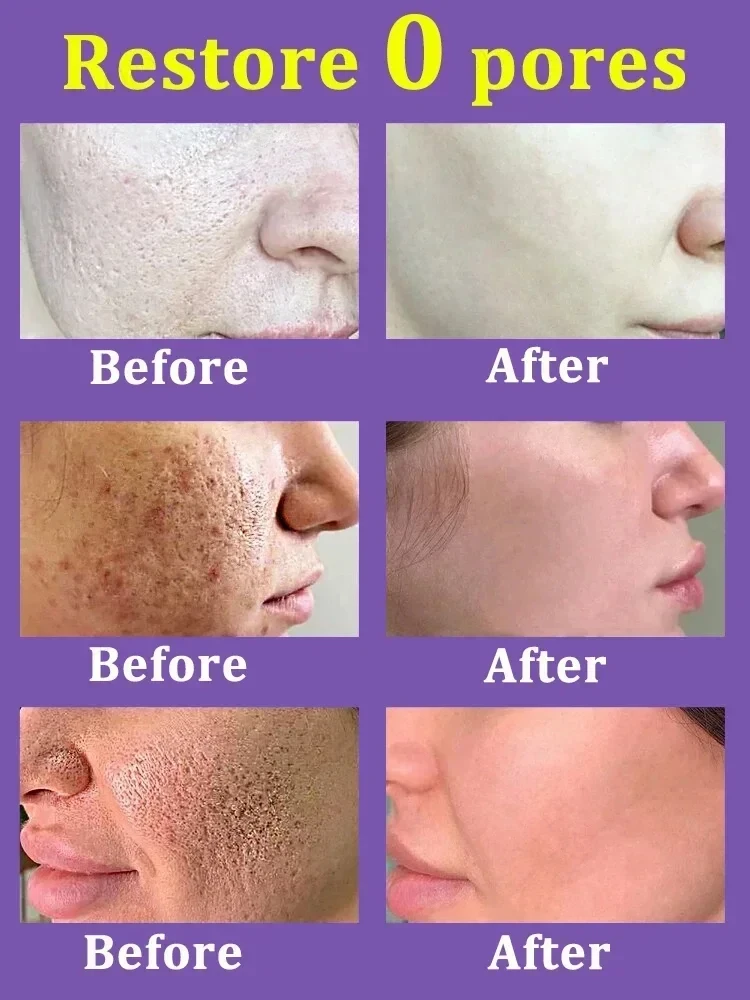 Lactobionic Acid Pore Shrink Face Serum Hyaluronic Acid Moisturizing Nourishing Essence Firming Brighten Beauty Korean Cosmetics 4