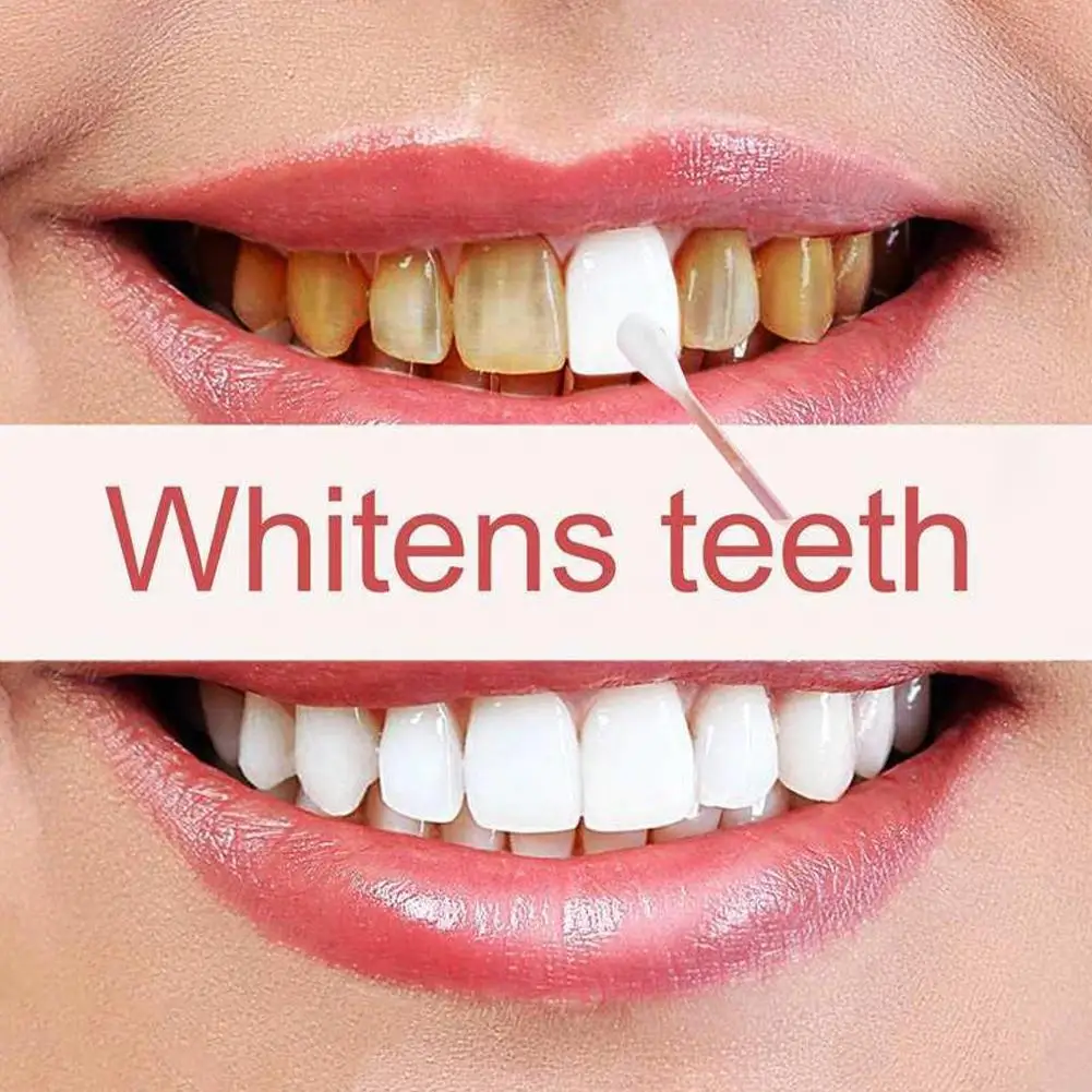 10g Natural Herbal Clove Thailand Toothpaste Tooth Whitening Toothpaste Dentifrice Antibacterial Tooth Paste teeth whitening product teeth health product