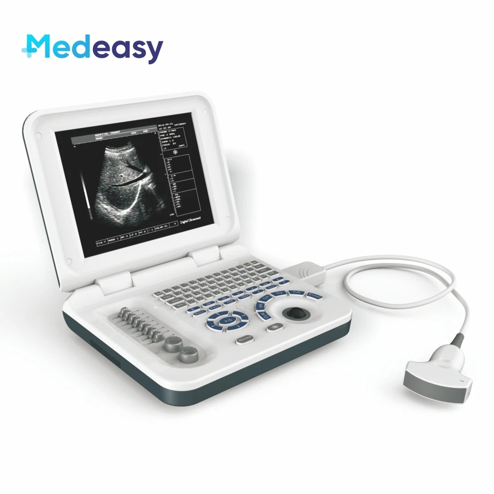 

10 Inch Full Digital LED Laptop Ultrasound Scanner Diagnostic System with 3.5 MHz Convex Probe
