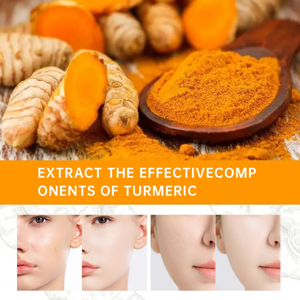 Turmeric Freckle Whitening Serum Anti-oxidant Nourishing Moisturizing Repair Skin Brighten Fade Dark Spot Essence Face Care 4