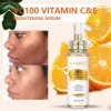 Effective Whiten Freckle Cream, Remove Dark Spot, Melasma, Fade Melanin, Anti-pigmentation, Improve Dullness, Fast Brighten 6